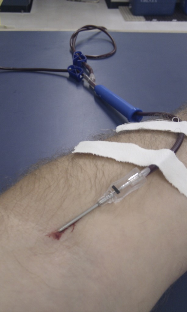 Eine Person Hand mit einer Kochsalzlösung und einer Nadel sowie mehreren Pflastern.