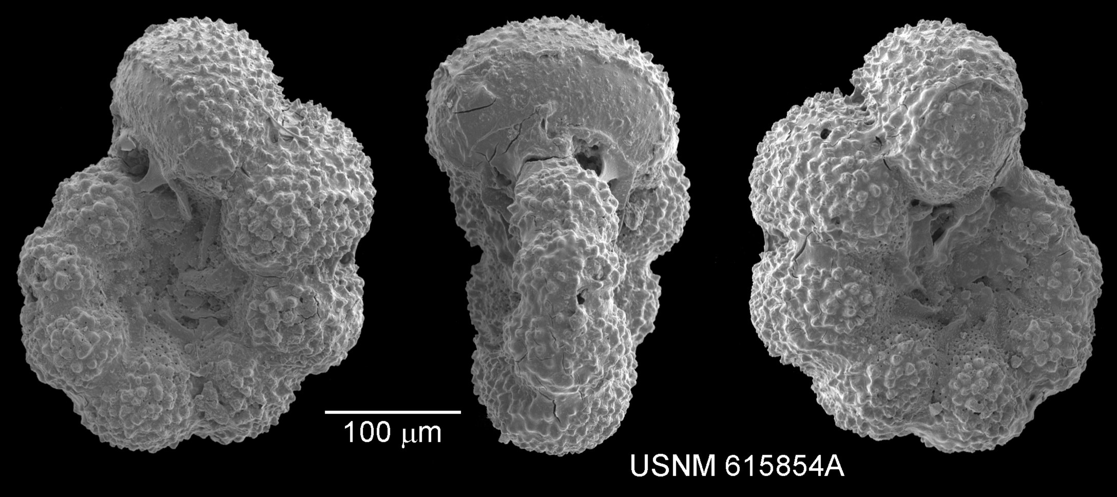 Schwarzes und weißes Mikroskopbild von drei verschiedenen Krebszelltypen auf einem dunklen Hintergrund, beschriftet mit "USNM 615854A" unten.
