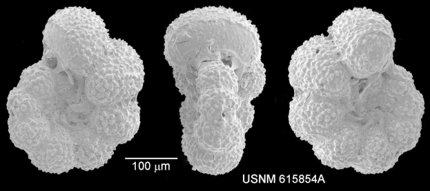 Schwarzes und weißes Mikroskopbild von drei verschiedenen Krebszelltypen auf einem dunklen Hintergrund, beschriftet mit "USNM 615854A" unten.